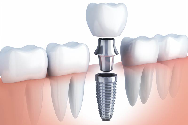 Dental Treatments in Philadelphia